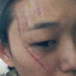 <b>안티팬</b> 습격 당한 최소라 오늘 모습