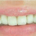 23살 흔녀의 고민