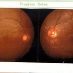 사진有) 상사에게 쳐맞고 눈이 실명될뻔함..