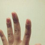 저의 <b>엄지</b>손가락에 하트를 없애고 싶어요