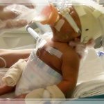 27주 4일에 태어난 이른<b>둥이</b>가 요렇게 변했습니다!!