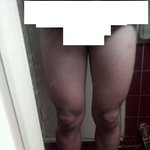 <b>형들</b> 나 다리 왜이러는지 알려줘