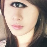 ★★(사진有)저앞트임햇는데잘됫는지봐주세요!!★★