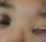 꼭 봐주세요 제여자친구가 폭행당했습니다..