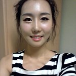 <b>양악</b>수술 김채연???? 대박