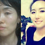 [미스에이전트/<b>노안</b>굴욕녀] 남편이 적극 찬성한 페이스라인 풀오프...