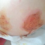 소아과의 우리아이 진료거부....