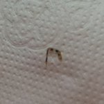 (사진주의!)벌레땜에 정신질환걸릴것 같아요..  이게뭘까요?? ...