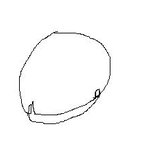 <b>발톱</b>이 발가락을 파고들어가요..