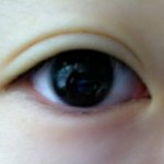 (사진有)쌍액+렌즈 전후 <b>before</b> &amp; after★★★★★★★★★★★