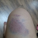 오늘아침 지하철7호선에서 모르는여자에게 맞았습니다.