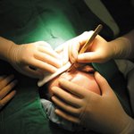 ##양악수술 위험///양악수술 부작용★양악수술 실패 양악수술