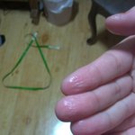 (심각주의)손에땀이 너~~~무많은 내 친구