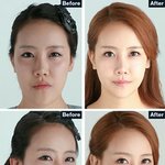 자기야 이신정 원장님 나오시네. 치아교정 때문에 잡지에서 봤는뎅