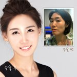 자기야 <b>이태희</b> 원장님 손끝에서 탄생한 미녀들