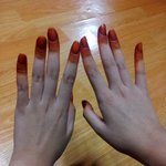 귀신손처럼 되어버린 봉숭아 물들인손ㅜㅜ