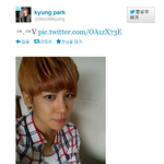 <b>박경</b> 성형에대한개인적 생각