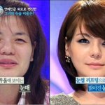 여자얼굴 <b>성형</b> 극과극(사진충격)