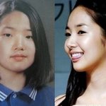 성형 성공 vs 성형후 <b>역변</b> 연예인