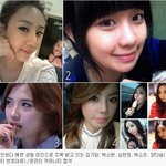 렛미인?! 성형미인 베스트5