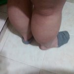 언니들 나 다리 왜이래