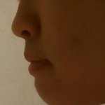 이정도면 <b>양악</b>해도 되나요....