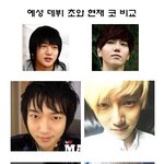 슈퍼주니어 <b>예성</b> 성형했나