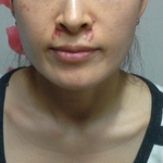 소송하고 싶은 엄마의 피부성형외과 후기