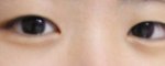 사진有有_)20대女, <b>쌍수</b>쌍수!