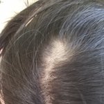 (사진有) 매직했는데 머리카락이 전부 끊어집니다.