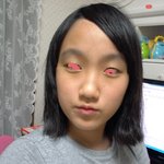 <b>이마</b>가 너무 넓어요ㅠㅠㅠㅠ