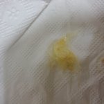 이<b>물질</b> 나왔는데 처리방법이없네요 ㅠㅠ 다들 조심하고 처리방법알아가세요...