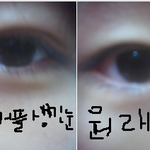 언니들ㅜ 쌍수햇는데 평가좀요ㅜ (!5살)