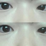 사진有+) <b>쌍수</b>가 필요할까요?