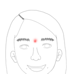 <b>미간</b>에 여드름요 어떻게 없애요 ㅜㅜ