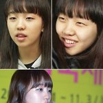 백아연 소희 닮은꼴 변신~ 몰라보게 달라진 <b>입매</b> 비결은??