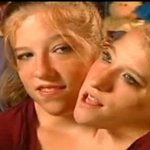 [허접의대생의 신기한 이야기들 3] - 머리가 두개인 자매 (샴쌍둥이)...