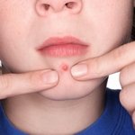 피부관리<b>Tip</b> - 이런 증상일땐 피부독소를 의심하라