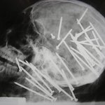 미스테리포토타임) 기괴한 <b>x</b>-ray 사진