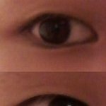 [사진有] 쌍커풀 없으면 성형 꼭 해야되는건 무슨<b>법인</b>가요...