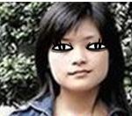 [<b>위드</b>성형외과/사각턱수술] 이제 드디어 나도 윤곽수술 하겠다!!...