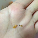 치킨을 시켰는데 양념치킨에서 철수<b>세미</b>가 나왔네요;;;