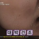 100인의 여자 보신분~~  거기에 나온 피부보<b>습기</b> 닥터수 맞나요??