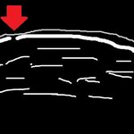 멀쩡한 내다리에 통깁스 하려한 돌팔이 의사ㅜㅜ 도와주세요ㅠㅠ