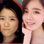 이건 무슨성형인가요?