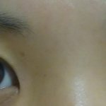 취준생인데 앞트임해야할까요? 눈좀봐주세요 <b>플리즈</b>