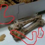 머리카락이 무더기로. 후라이드 치킨