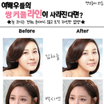 여배우들의 쌍커<b>풀이</b> 사라진다면?