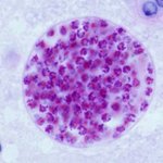 (신기)숙주를 조종하는 인체감염 기생충