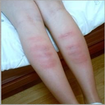 (사진)<b>폭행</b>당했는데 어떻게 하면 되나요?